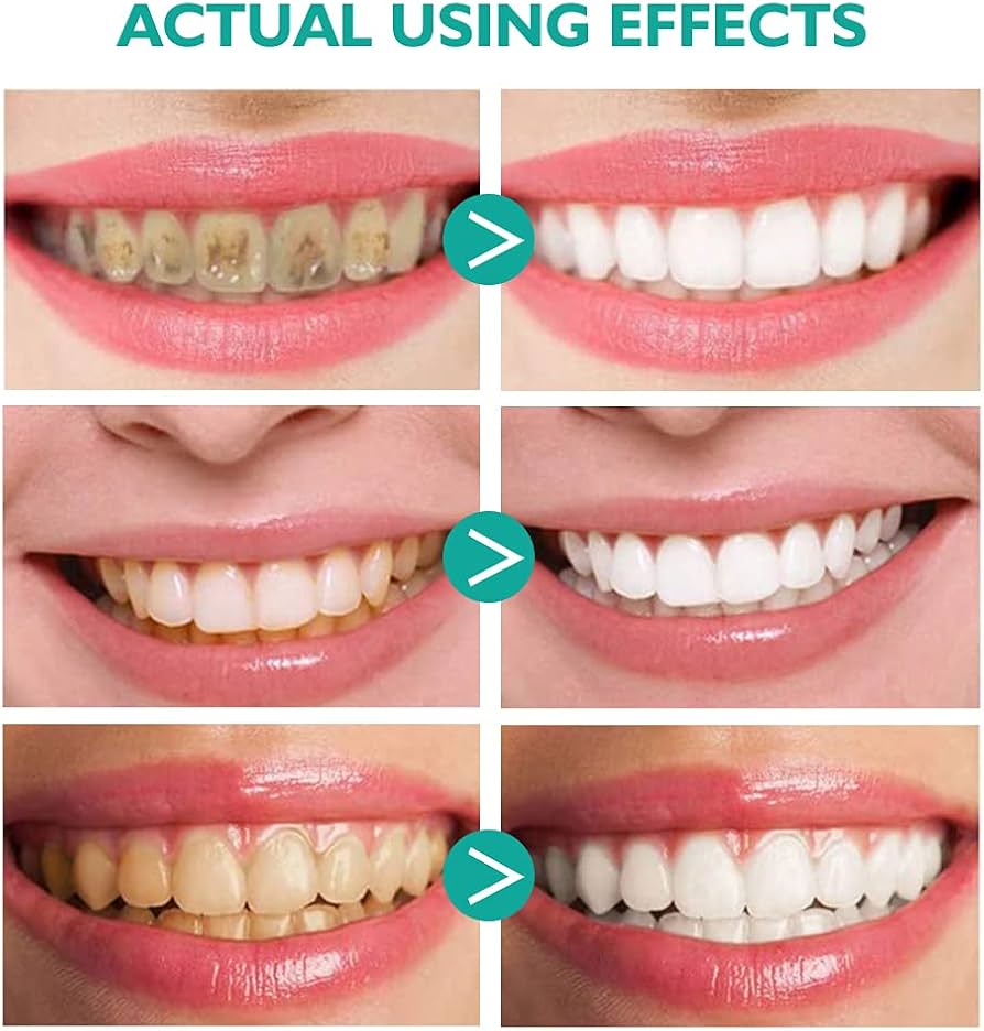 Foam Toothpaste